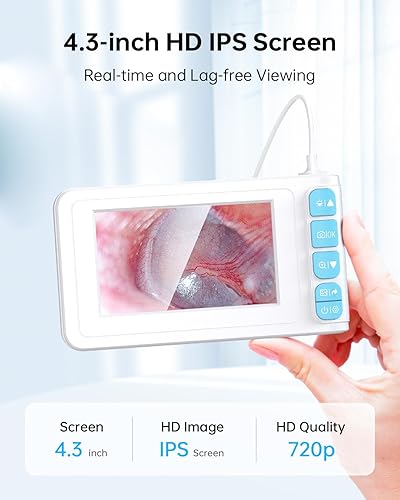 4.3 Inch IPS Digital Otoscope - Ear Wax Removal Tool Camera with Light, Supports Photo Snap and Video Recording - Poueer